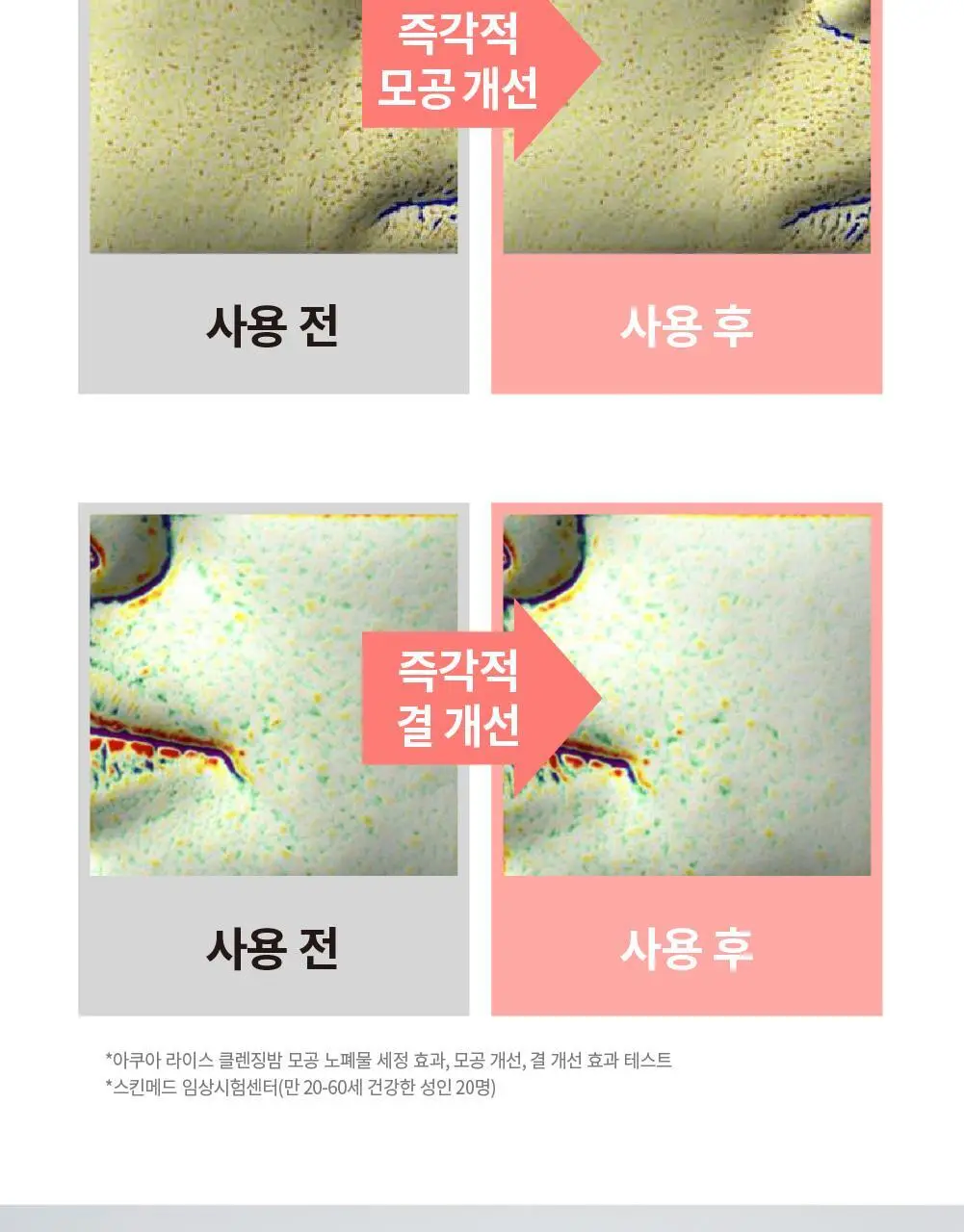 [메이크업순싹/쫀득백설기밤] 에스네이처 아쿠아 라이스 클렌징밤 90ml 상세페이지 23